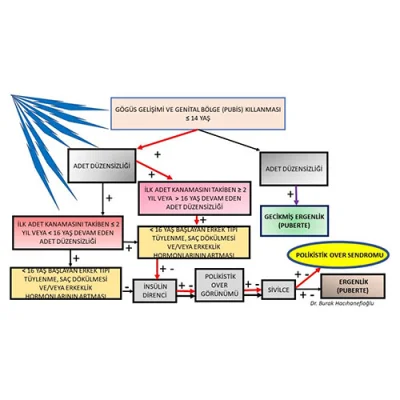 16 Yaşından Küçük Kızlarda Polikistik Over Sendromu
