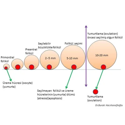 Polikistik Over Sendromu’nda Adet Düzensizliği ve Tedavisi