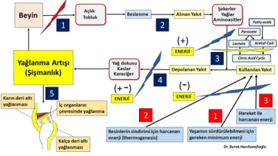 Polikistik Over Sendromu’nda Kilo artışı ve Şişmanlık