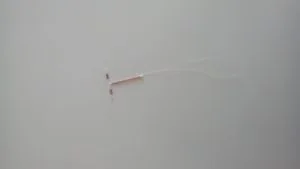 Rahim İçi Araç (Spiral) Kullanımı ve Polikistik Over Sendromu